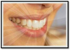 HURRY!!!! Only 10 days left to get your hands on our combined teeth whitening and tanning offer!!!!