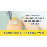 Fungal Nail Treatment with Laser in Telford and Shrewsbury
