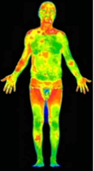 Medical Thermal Imaging Ltd - Guildford