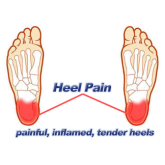 Shropshire Foot Specialists - The Telford based Heel Pain Experts
