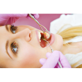 Frequently asked questions when choosing a private dentist