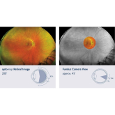 Chineham Centre Optician Offer Optomap Retinal Imaging