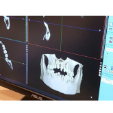 State of the art 3D imaging available at Elmsleigh House Dental Clinic, Farnham