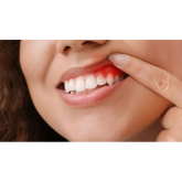 5 Ways To PREVENT Gum Disease by Brookside Dental