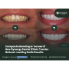 Composite Bonding or Veneers? How Synergy Dental Clinic Creates Natural-Looking Smile Results