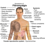 What is Fibromyalgia?