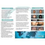 Direct Hair Implantation Now Available at Synergy Dental