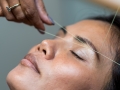 Recommended Cosmetic Treatments in Walsall