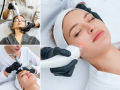 Skin Clinic in Eastbourne