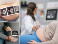 Baby Scanning in Eastbourne