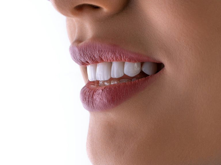 Dental Implants Open Event at Esthetique Dental