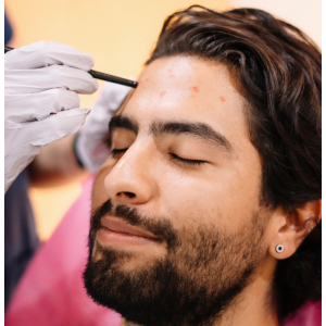 Can You Have a Second Hair Transplant
