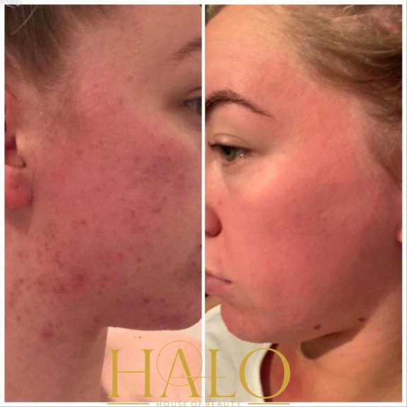 Halo House of Beauty - Walsall