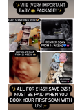 Very important baby package all for £145 at Genesis New Beginnings 