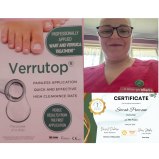Verruca Treatment Plans Now Available at Caring Feet Walsall