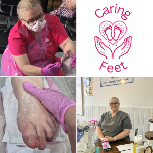 Caring Feet Walsall – £27 Mobile Foot Health Care for New Clients
