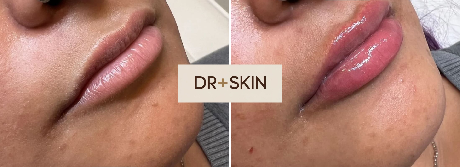 69a5abf8fb70e75a5f499812